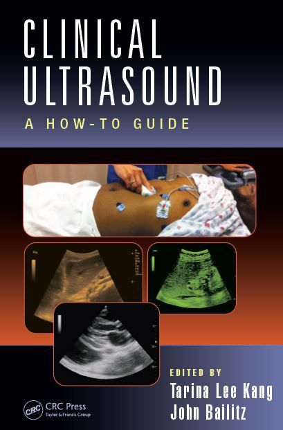 ebook understanding the hivaids epidemic in the united states the role of syndemics in