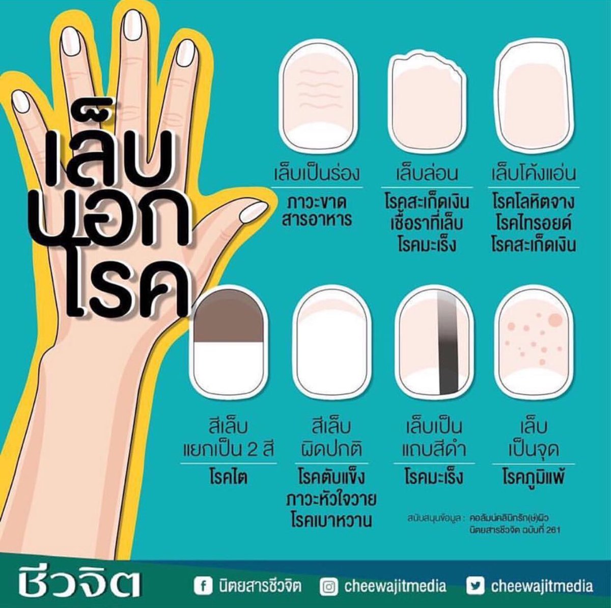 Justwanna_'s tweet photo. อันนี้น่าสนใจปกติไม่เคยสังเกตเล็บตัวเองเลย แต่มันบอ���โรคได้ด้วยยังไงลองสังเกตกันดูน้าาา👍🏻 https://t.co/sYlrJvxFyC