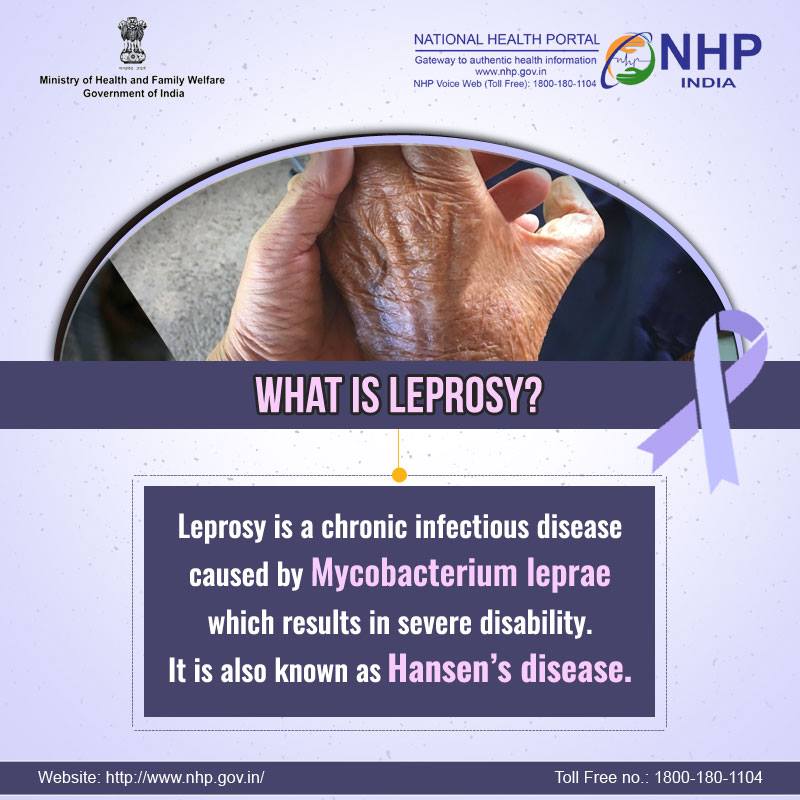 NHPINDIA's tweet photo. #Leprosy is a chronic infectious disease caused by a bacillus, Mycobacterium leprae.
Read more at: https://t.co/ffUNQ56EuV
#SwasthaBharat #HealthForAll #AyushmanBharat https://t.co/UrN3nkfS0P