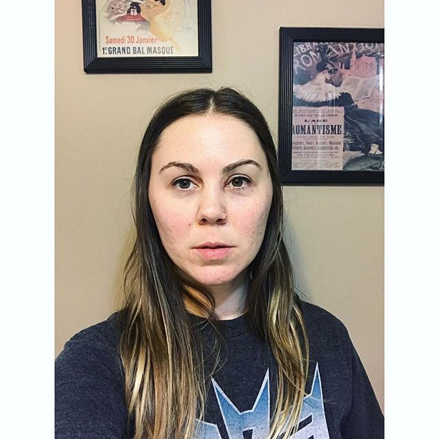 HonestOctober's tweet image. From @rickelle_yeah
・・・
Ugh! My face is apparently on a mission to take over #honestoctober or something. I hate posting another picture of my face, but my eye is swollen and I have to run errands. 😖 I’m half-heartedly considering wearing an eye patc… ift.tt/2CtaFOE