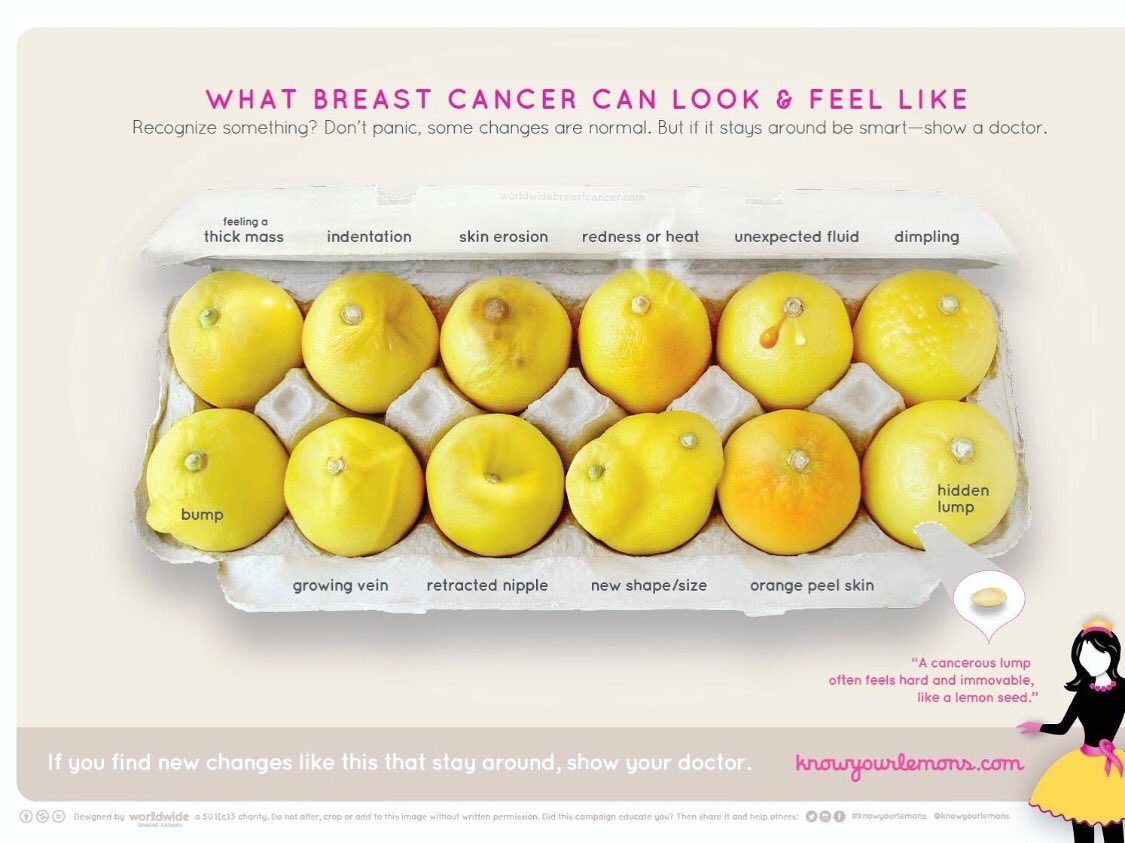 DrAmyVoci's tweet photo. It’s not always a lump! Be familiar with your breasts so you are able to recognize changes to the your skin as well. @LCI_YWBP @AtriumHealth #LevineCancerInstitute #screeningsaves #BreastCancerAwareness #bcsm #BCSM #LCIywbp #LCIBreast #MondayMotivaton https://t.co/TcCBHZJPei