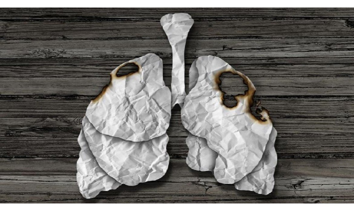 Bergstrom_Mx's tweet photo. #MiSemanaLaComienzo dandonles esta info: Fumar es una grave enfermedad que te va consumiendo poco a poco, la cual puede llegar a destruir tu cuerpo. Las personas que fuman reducen su calidad de vida. https://t.co/iohvqEQ0l0 https://t.co/zuKiWxUAkK