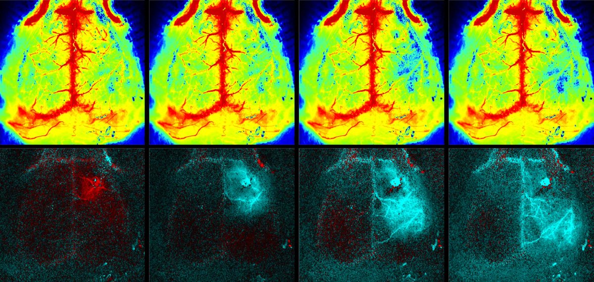 perimedgroup's tweet image. Visualize spreading depolarizations in real-time with high resolution using PeriCam PSI. Come by our booth @Neurorepair conference in Dresden Oct 9-11th. #PeriCamPSI #spreadingdepolarizations