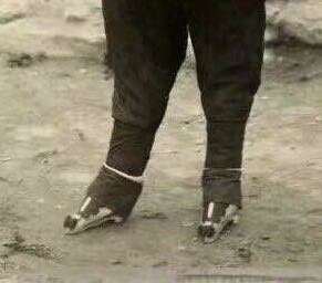 CFootbinding's tweet photo. 河北邢台式弓鞋，鞋底前后墊軟墊，好走不出聲，前掌細瘦，有點折足腕，弓鞋前端綴飾大絲穗，是晚清造型，這式小腳前掌纖瘦，不太短小，估這弓鞋長度在十六厘米左右。很奇怪的是，小腳後跟前推才會出現折足腕，折足腕小腳走路還算方便，比較瘦長腳掌，這腳呈丁字型打開，站立平穩不需扶持，能停下照相 https://t.co/SbTNzWJyet