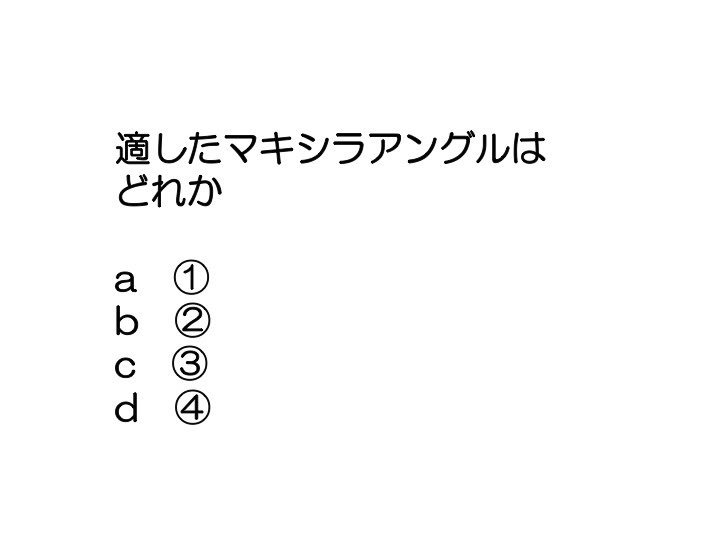 第25回 歯科衛生士 国家試験問題 午前 問題72