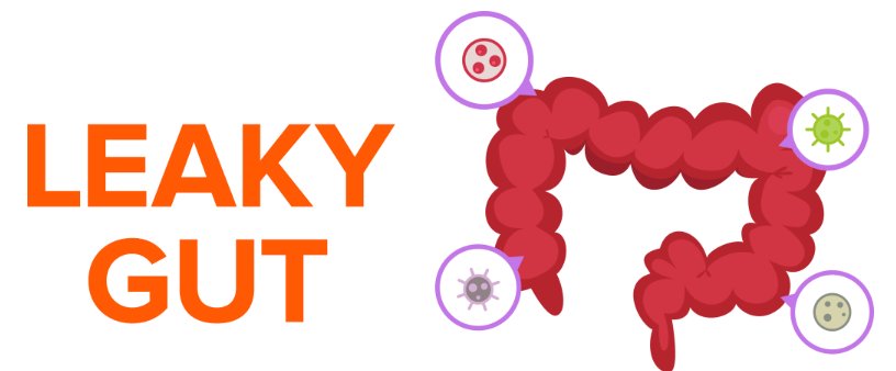 SupplementHunt's tweet image. Leaky gut syndrome (LGS) is a medical condition that's thought to be the result of a malfunctioning intestinal system.

Checkout these 7 easy hacks we've compiled to address Leaky gut syndrome so you can feel your best!

supplementhunter.com/leaky-gut-diet…

#leakygut #leakygutsyndrome