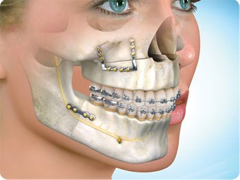 PlasticMeet's tweet photo. #Call_for_ABSTRACT submission on #tracks:#Oral_Maxillofacial_Surgery
#Abdominoplasty
#Mammoplasty
#Body_contouring
#Maxillofacial_surgery
#plastic_surgery
 For more information visit:……https://t.co/gPKWxAPdrr https://t.co/pctpaRghHG