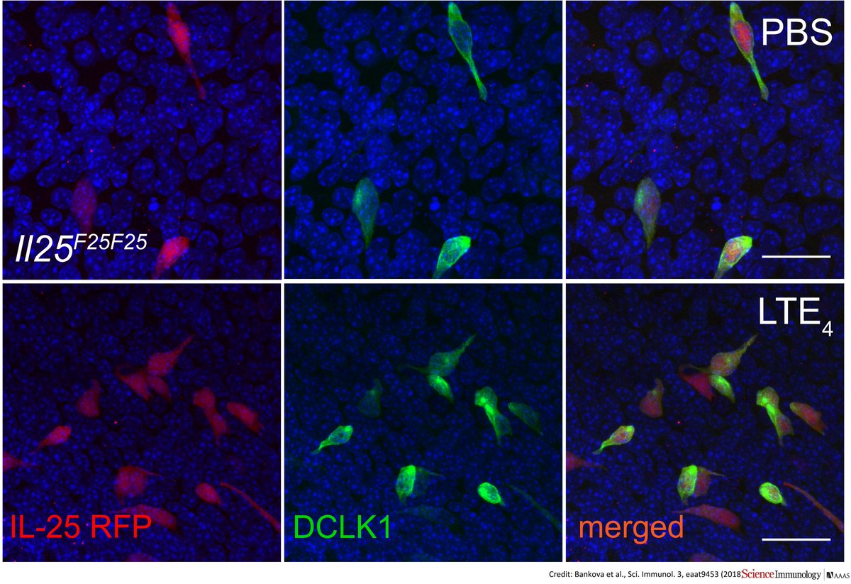 More than just "passive cells" brush cells in the airway passages can play a very active role in big #inflammatory responses, say <a href="/harvardmed/">Harvard Medical School</a> <a href="/BrighamWomens/">Brigham and Women's Hospital</a> #scientists: bit.ly/2On3Vs5
