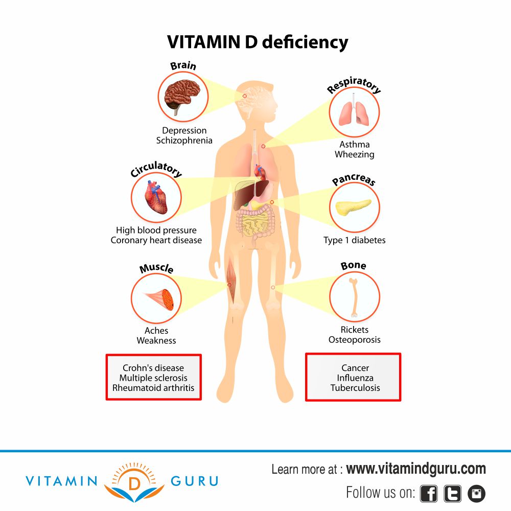 Vitamin deficiency. Vitamin d deficiency. Vitamin в3 deficiency Symptoms. Vitmain d deficiency Symptoms.