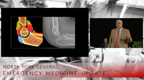 EMCases's tweet photo. EMU 365 video release:
Pediatric Elbow Nightmares with @arunsayal1
#FOAMed #FOAMped
https://t.co/v9Gwsk2aD1 https://t.co/r32dL01hHS