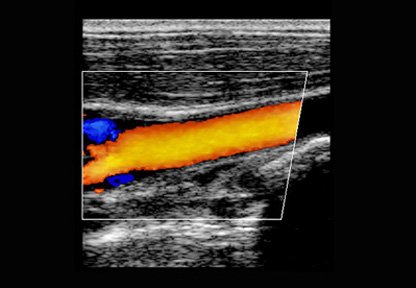 USDWestMidlands's tweet photo. October is Medical Ultrasound Awareness Month (#MUAM2018) - do you know all the things ultrasound can be used for?
We offer scans of *almost* the whole body, to investigate a variety of conditions: we are so much more than a pregnancy scan company... https://t.co/rTFxXjAkRw https://t.co/Q3CJaIQKRL