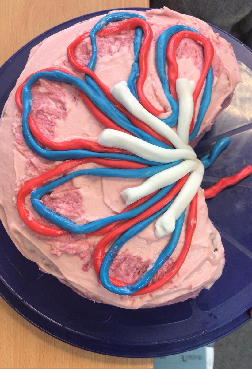 BWC_dietitians's tweet image. How about cake #2 for the week - Sara’s chocolate sponge single kidney #GreatDieteticBakeOff #gdbo #GBBO2018 #extraslice