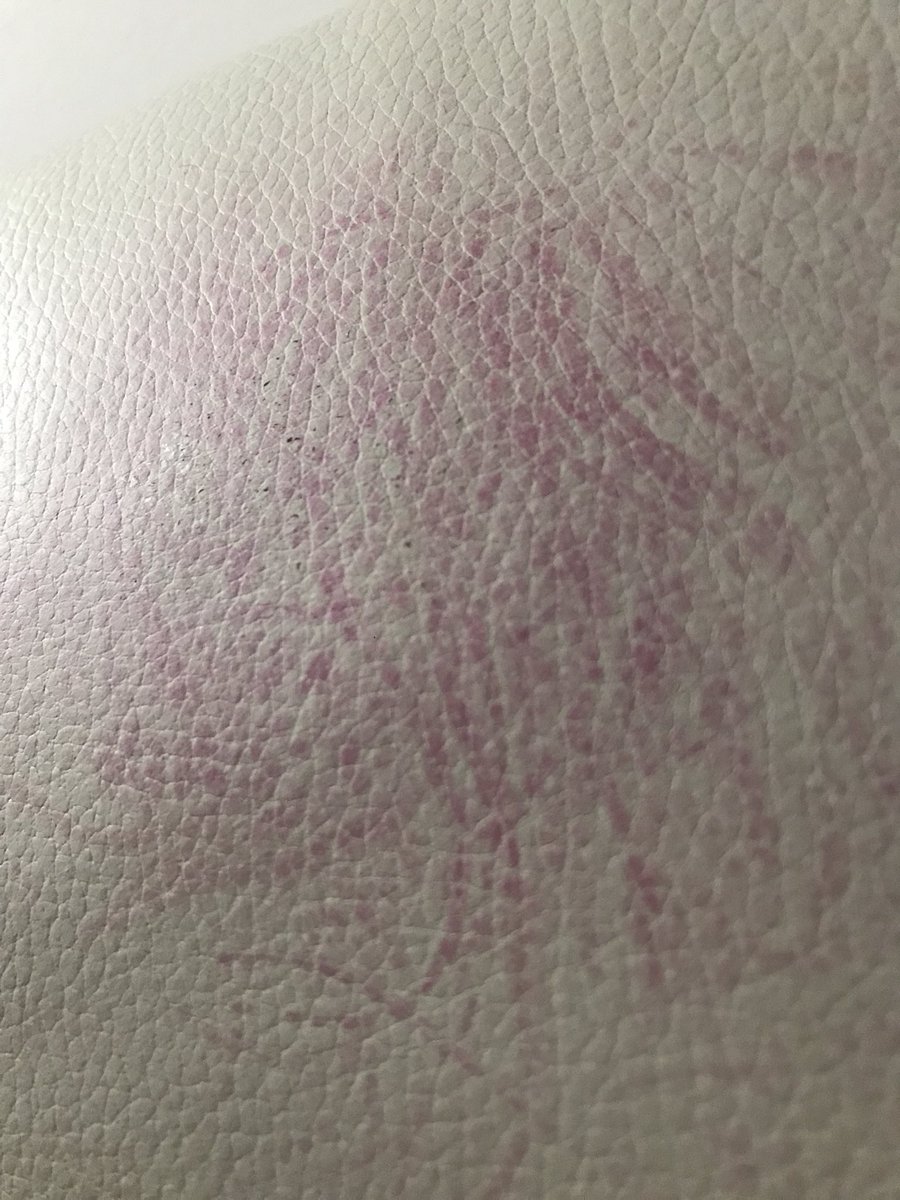 mickeygggnyc's tweet photo. @joliekerr HALP my @oVertoneColor transferred from my wet hair to my leather couch. 24 hours ago. Have tried leather cleaner and this hair color stain remover (which dried out the leather). Nothing making a difference. Is there any hope?? https://t.co/GVVNGZHPmW https://t.co/ApInBGveiv
