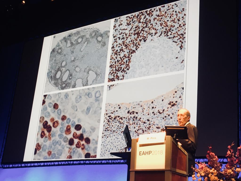 drpabloortiz's tweet photo. I feel proud and excited. One of my mentors, Dr Miguel Ángel Piris, received the Karl Lennert Award from the European Association for Hematopathology. THANK YOU VERY MUCH for teaching and guiding me for so many years. You really deserve this award
#dermatology
#lymphoma
#EAHP2018 https://t.co/m7rT9mGiDp
