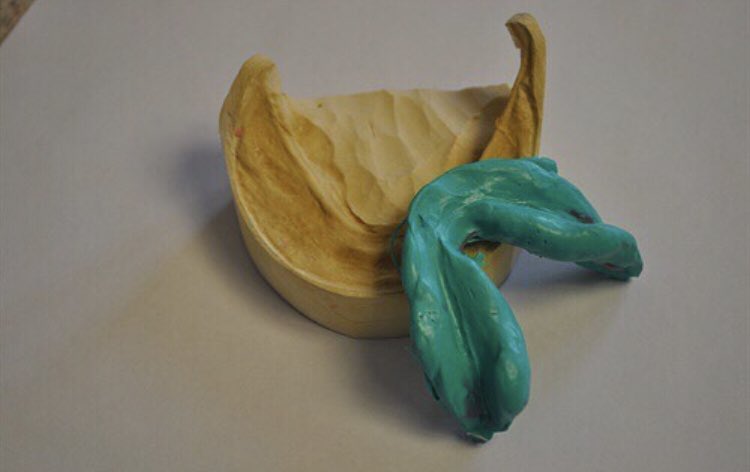 RyanMcCallDDS's tweet image. #NoBone 🤨