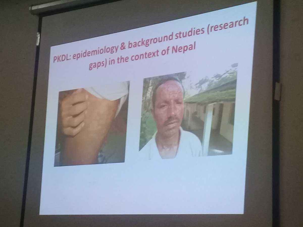 Yeti4mNepal's tweet photo. Consultative meeting re: #Dengue &amp; #PKDL at #VBDRTC #Nepal - Thank you all #EDCD #STIDH #TU #BPKIHS @mohpnep https://t.co/nZgr8iejxF