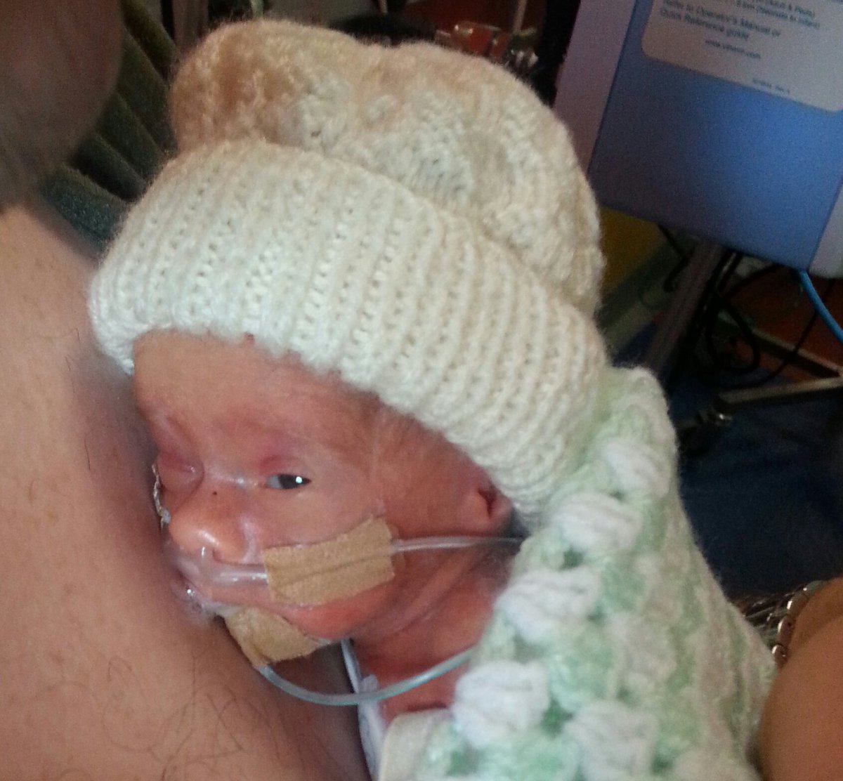 AndyGreeves's tweet photo. This week (9-15 Oct) is Baby Loss Awareness Week. I spoke to @Blisscharity about my beautiful son Toby, who passed away in 2014 aged just 23 days. This is our story... https://t.co/4y86GkM5D8 #BLAW2018 @BLA_Campaign https://t.co/ilLmvn5r8K