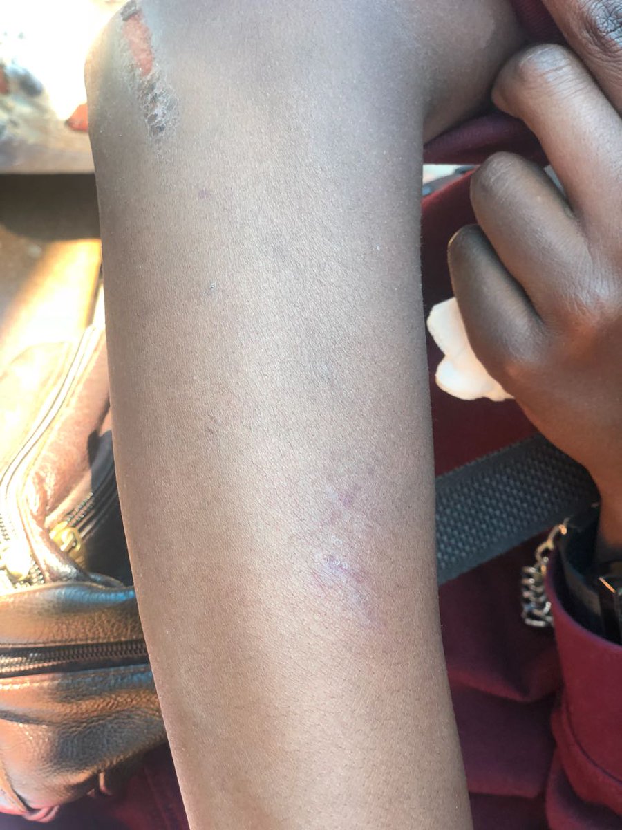 tog_universe's tweet photo. Hey @Aandklas_Pta what's going on? We get beat up for kissing White girls now? 💔 https://t.co/31dDyG9IxY