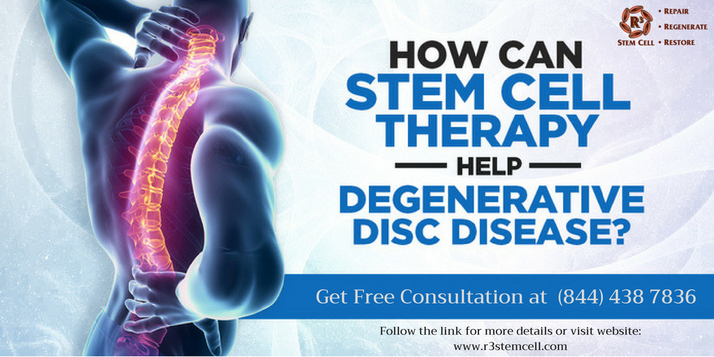 TaylorFriedel's tweet photo. Get the safest and effective Stem Cell Therapy for Degenerative Disc Disease.
Know more ➡  https://t.co/EFvPJ4U8f0 
#RotatorCuffTears #RotatorCuffTendonitis #TampaBayFL #SpinalStenosis #Tendonitis #TensionHeadaches #TrigeminalNeuralgia #Tampa #Florida https://t.co/QMNLeBthe6