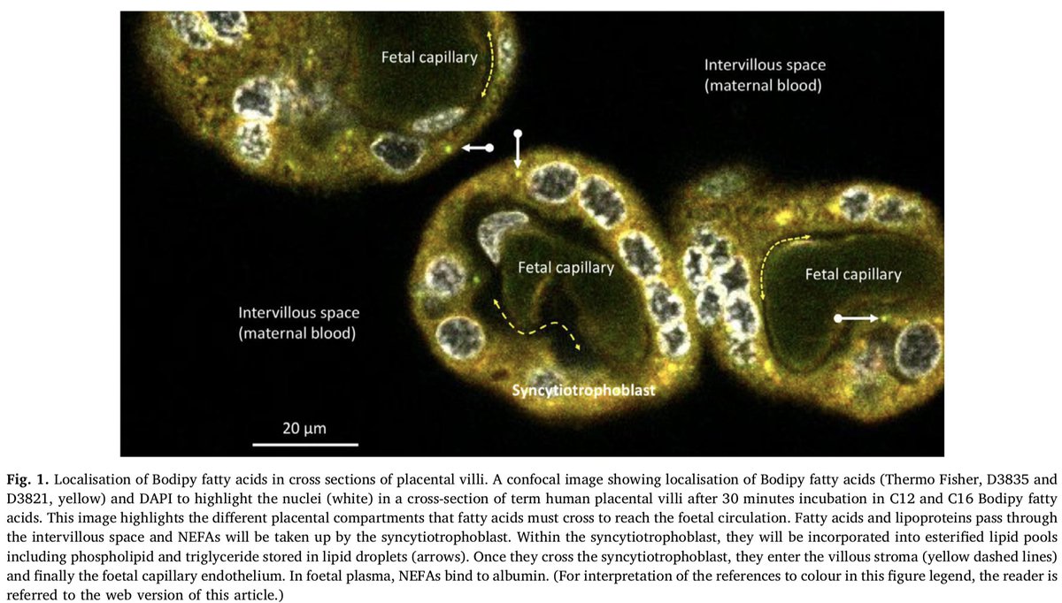 r_m_lewis's tweet photo. Do you want some New Perspectives on Placental Fatty Acid Transfer? See our new review in #PLEFA with Philip Calder and @DrCEChilds https://t.co/YMeHLJftyy @IFPA_Official @uos_medicine @uos_IDS https://t.co/rLGrbHV7E9