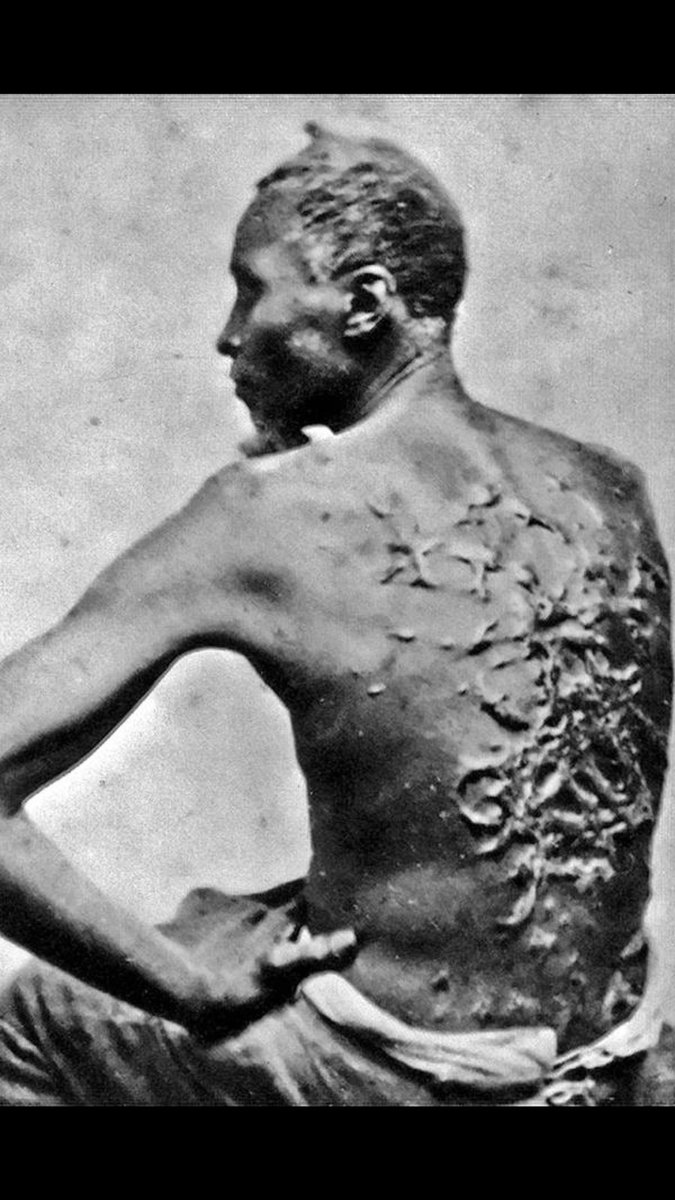 Fresh_Flames1's tweet photo. #WednesdayWisdom
#WorldMentalHealthDay
#HiddenHistory
#Drapetomania Was Another
Wicked Mental Health Illness
Only Curable By Whipping
Diagnosed To Runaway
African Slaves In America
Created By The Sick Devil
#SamuelCartwright https://t.co/TD5CyTqkZ8