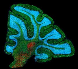 Niemann-Pick disease type C1, a lipid storage disorder, as seen in a mouse cerebellum