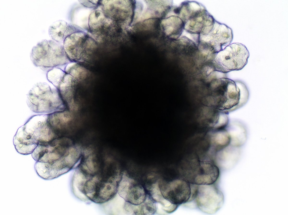 Bruno_C_Pereira's tweet photo. Have a good #StemCellAwarenessDay! #intestinalorganoid https://t.co/FW8zXMERlF
