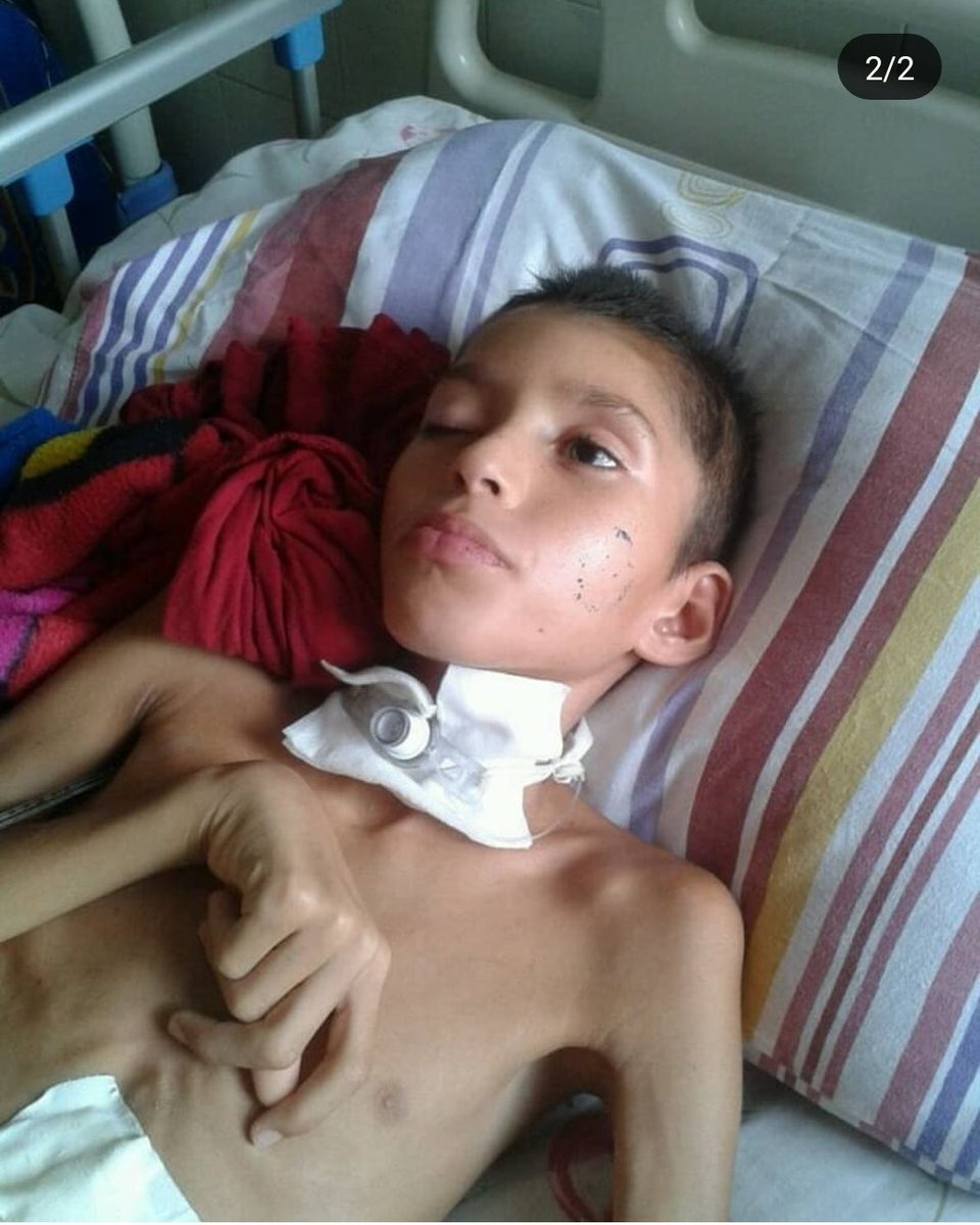 __jarc's tweet photo. Yo jamás he solicitado ayuda por este medio, pero este caso me tocó demasiado la fibra desde anoche. Se trata de un niño de 10 años que tuvo un accidente automovilístico y se encuentra en el hospital Razetti de Barcelona. Cualquier ayuda monetaria o un RT serian de gran ayuda. https://t.co/hTVy7j1kGw
