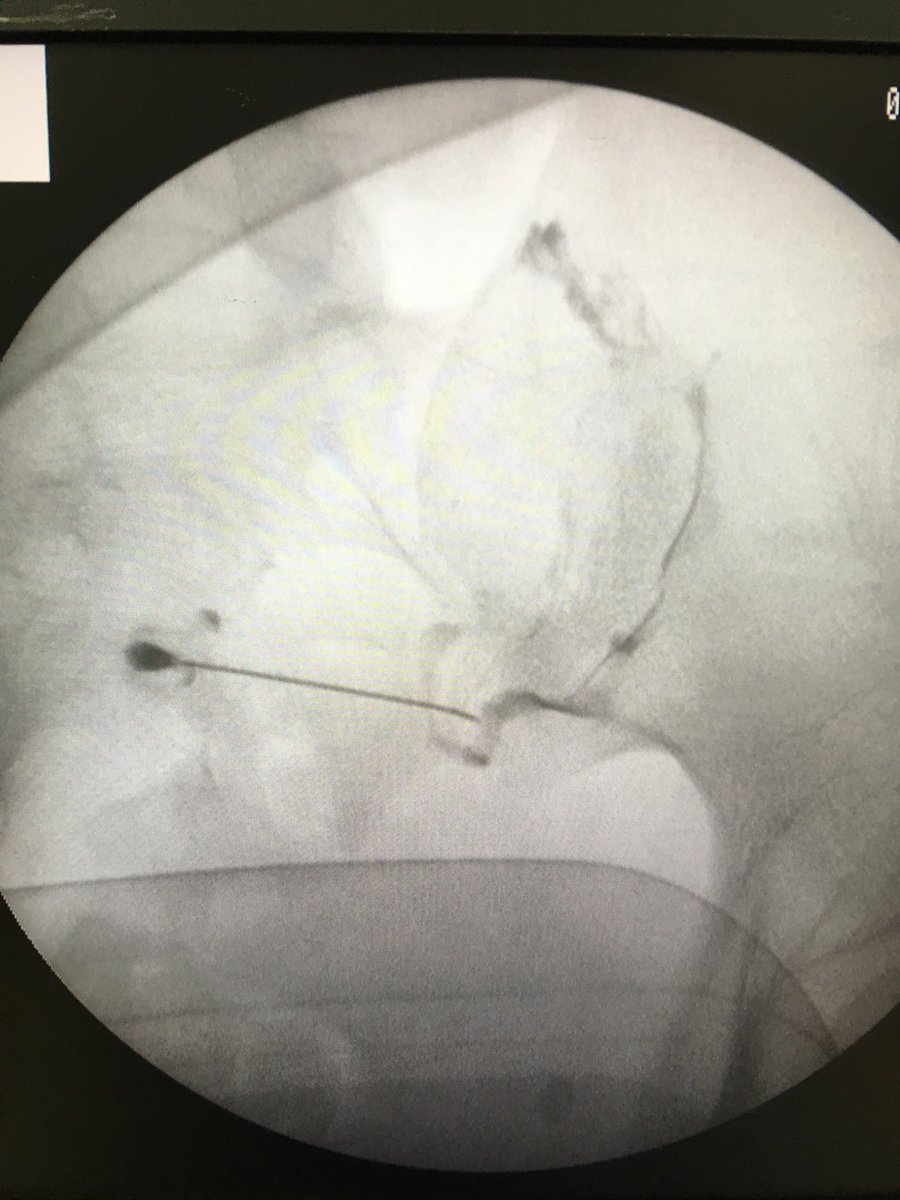 Sergi Boada Pie tweet media