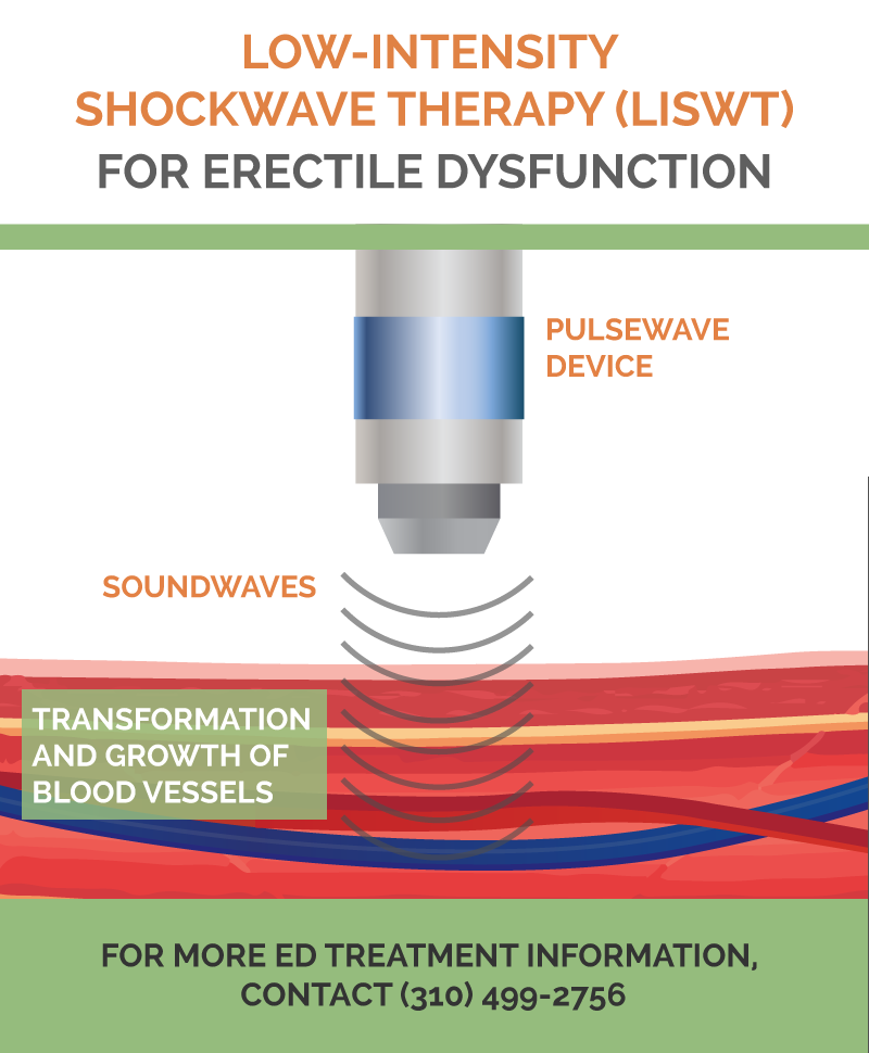 UrologyLA's tweet photo. Ditch the little blue pill and learn about an innovative #erectiledysfunction treatment called low intensity shockwave therapy which involves no medication!  #liswt #pulsewave      https://t.co/MUJYe4SiEu https://t.co/o0QWdBZdmZ