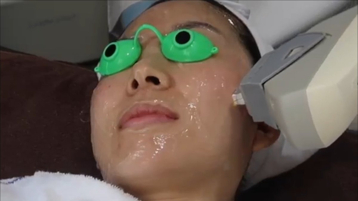 peronis's tweet image. Elimina definitivamente las pecas con el IPL …ulsadaefectossecundarios.blogspot.com/2018/10/como-l…