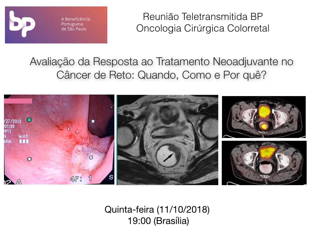 É hoje!!! Não percam!!! 19hs!!!
Link: Hoje!! 
my.cloudsolut.com/stream/d278c99…