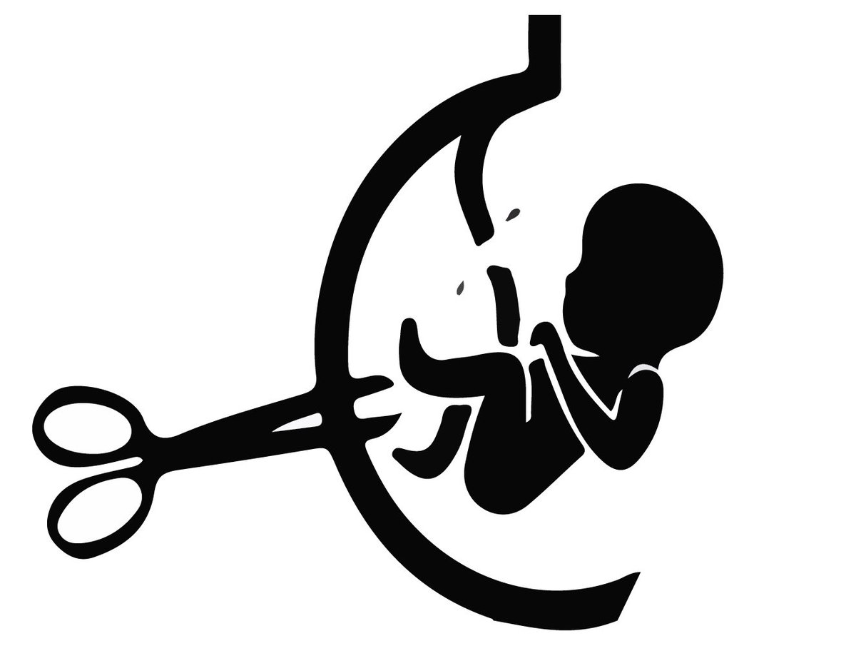 vidaparanacer's tweet photo. Los pro aborto, siempre mencionan en sus argumentos la violación,la pobreza, que se formarán familias disfuncionales y embarazos entre adolescentes, ¿No sería mejor invertir en prevenir esos asuntos,en lugar de tapar el sol con un dedo,como es el aborto? https://t.co/PS0u12Kzpi