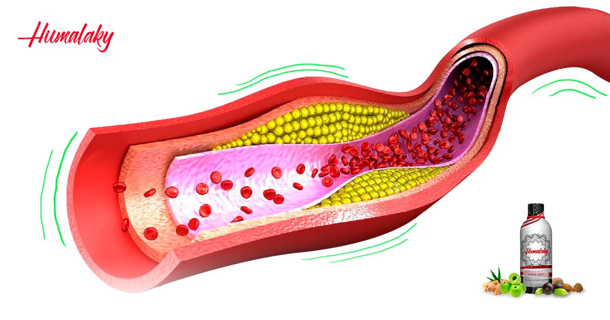 HumalakyC's tweet image. Los excesos de toxinas pueden ocasionar enfermedades al corazón, limpia tu organismo con nuestra bebida antioxidante Humalaky. 

¡Déjanos tu número!

#Bienestar #Humalaky     
#dolor  #Ansiedad