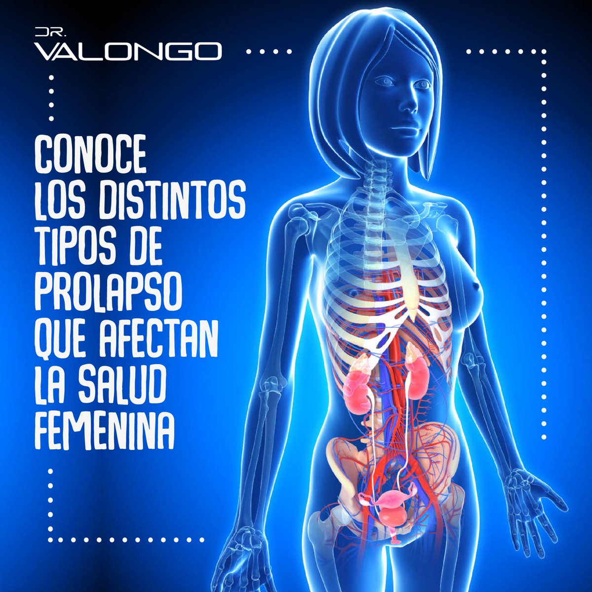 Producto de los embarazos, los partos vaginales y la disminución de estrógenos asociada a la menopausia, algunas mujeres pueden presentar diversos tipos de prolapso, conócelos: instagram.com/p/BnAFdD5gOun/…