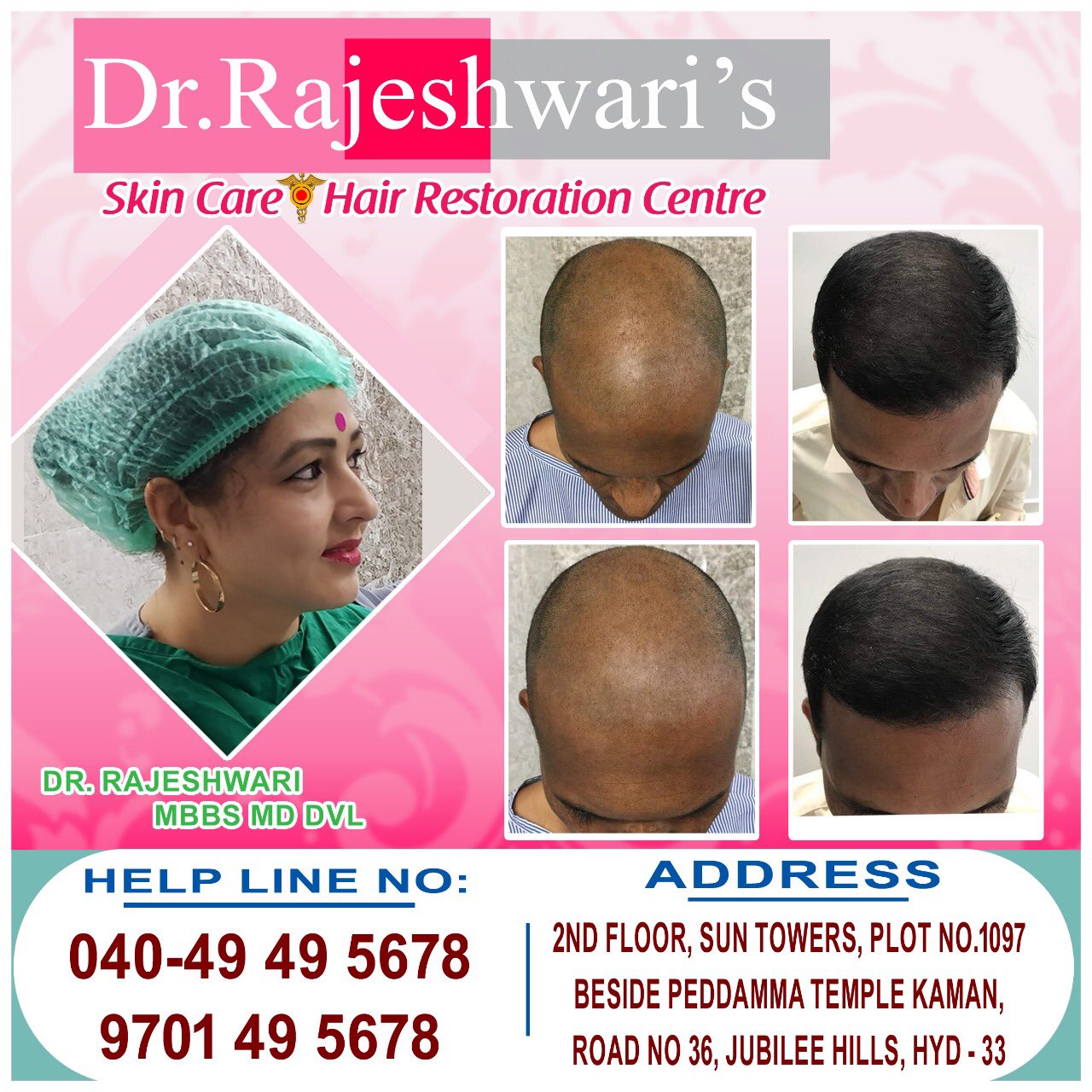 dr rajeshwari skin and hair clinic jubilee hills
