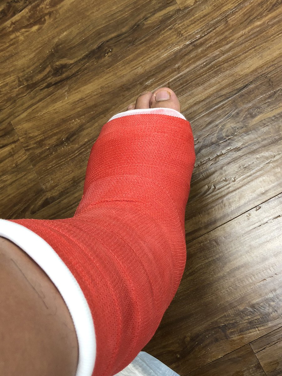 NewPatientGroup's tweet photo. Update on our Chief Client Relations and Marketing Officer Vinh... He is four weeks away from physical therapy for his left foot! New cast today! #newpatientgroup #npg https://t.co/97o2thAvUM