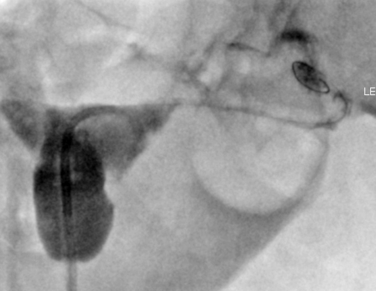 Kumar Madassery tweet media