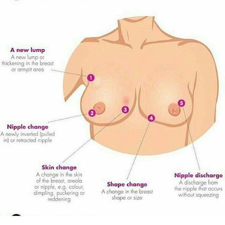 Captured_Ville's tweet photo. Lets create the awareness..
#NoBraDay https://t.co/32C5CUxuri