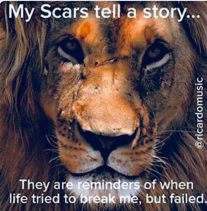 missspeeds's tweet photo. Love this 🙏🏽♥️ . New journey starts Monday Massive operation 1 of 3 . Scared like but like it says will not break me 👊🏽 #doublemasactomy #breastcancer #reconstrution this time next year hopefully be all clear and all in the past 🙌🏽🙌🏽 https://t.co/KKeGrT1Z7U
