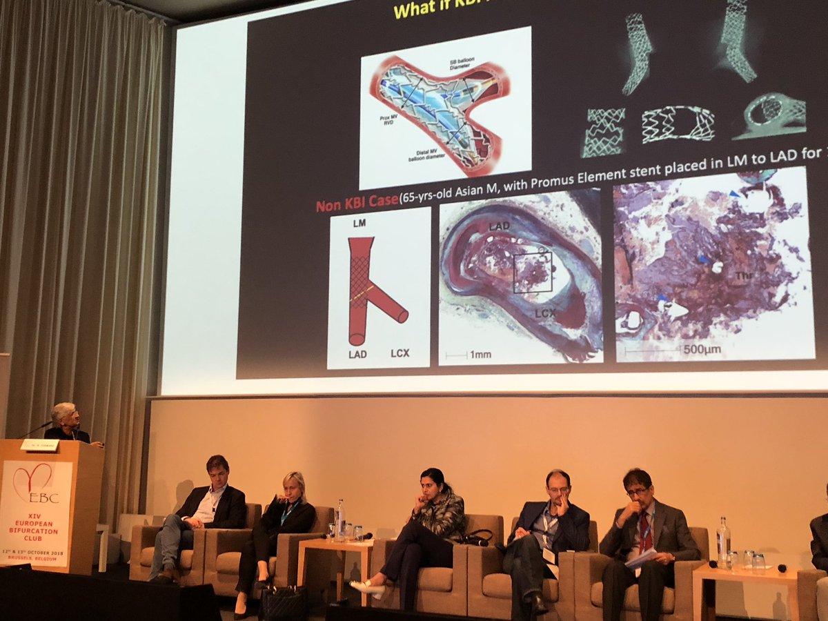 stefan_harb's tweet photo. Reinu Virmani offering exciting insights to shear stress and plaque distribution #EBC2018 https://t.co/P4fLhVUpaU