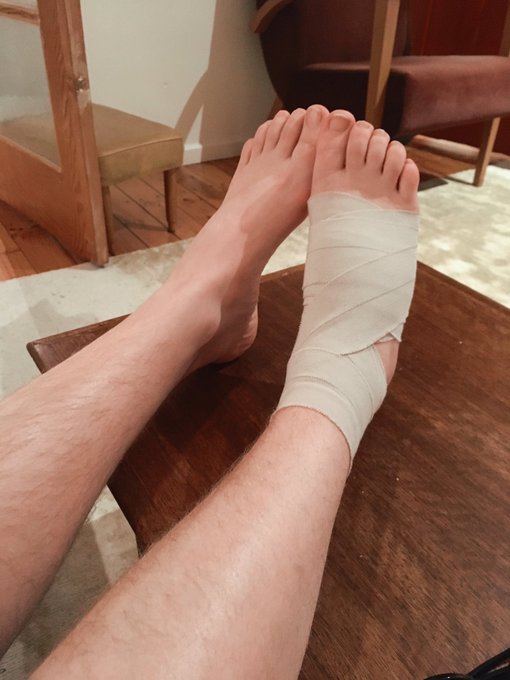 My poor beautiful foot. She works so hard for me and now I must take good care of her. https://t.co/<a href="/tag/newprofilepic"class="tags"><span>#newprofilepic</span></a>