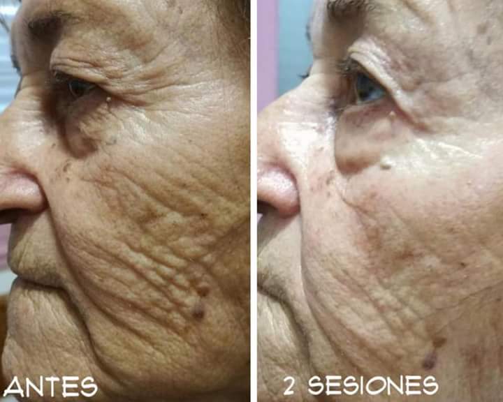 Podes embellecer y tener tu spa en casa😍