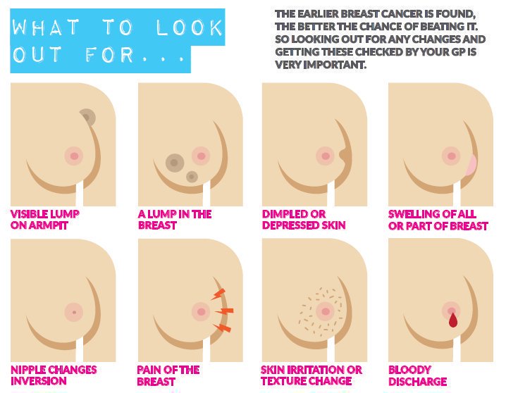 DrRichardCross's tweet image. Don&apos;t do it. Don&apos;t scroll away until you RT and ♥ this message. Early detection can save lives! 
#NoBraDay