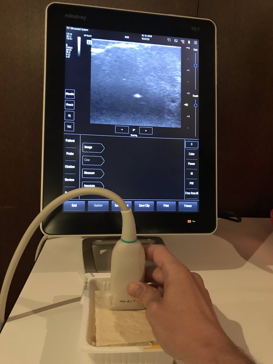 Ultrasound-guided IV access takes practice, so make it quick and easy. Use a block of firm tofu with a coffee stirrer stuck inside as a target for your needle to hit ($3). Easy to do before a shift!