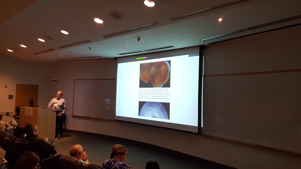 MORL_UIowa's tweet photo. Great insights into the pathophysiology of #Drusen in #C3G and the necessity to understand whether certain interventions can prevent or slow progression from Dr.Tom Oetting @uiowaeye @uihealthcare https://t.co/u4HDbw62eZ