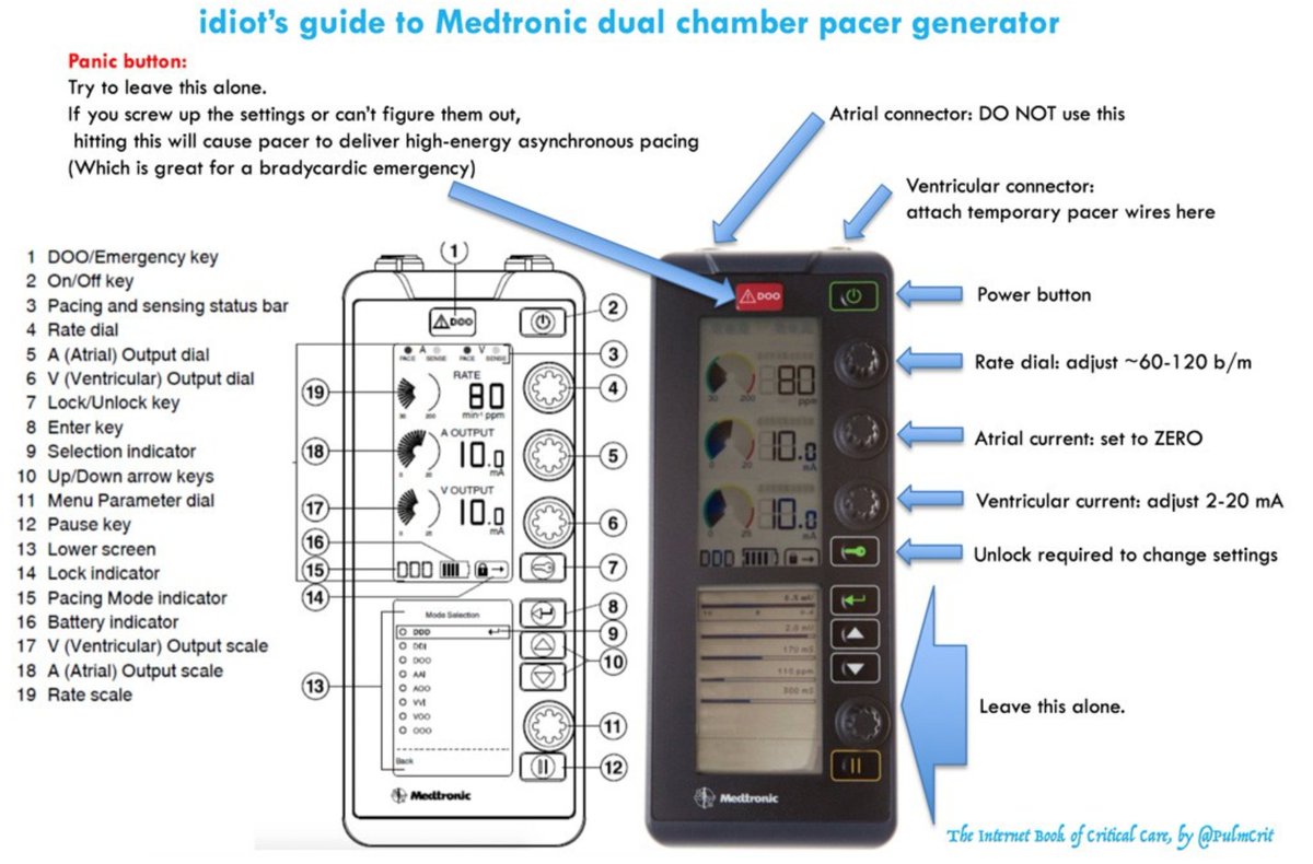 Bradycardia via <a href="/PulmCrit/">𝙟𝙤𝙨𝙝 𝙛𝙖𝙧𝙠𝙖𝙨 💊</a> emcrit.org/pulmcrit/brady… #FOAMed