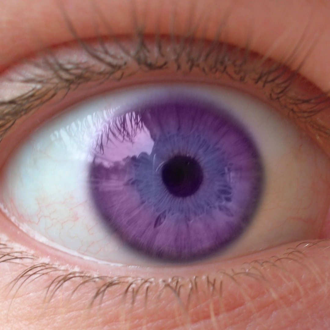 Fact Maniac Naturally Purple Eyes Exist This Is Due To A Disorder Called Alexandria S Genesis Which Causes Pale Skin And Purple Eyes Factmaniac T Co Rwovfkd2bu