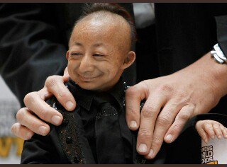 Kim Kardashian: Kanye boo it's the full moon , lets camp out. The view is so romantic 😍❤ 

Ugandan mosquitoes👇🏾👇🏾 
#KanyeWestInUganda