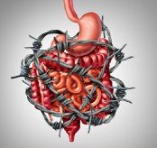 AsZpDexVCAxpgNu's tweet photo. تنتج البدانة عن عدد من الأسباب، والعوامل المساهمة: الوراثة. أسلوب الحياة العائلي. انعدام النشاط. النظام الغذائي الغير صحي. بعض المشاكل الطبية. بعض الأدوية. المشاكل الاجتماعية والاقتصادية. السن. الحمل. الإقلاع عن التدخين. قلة النوم.
#اليوم_العالمي_للعيون ٍ
#لا_للبدانة https://t.co/YbszIMpg7b
